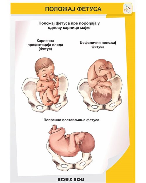 БП104 - Положај  фетуса  (постер)